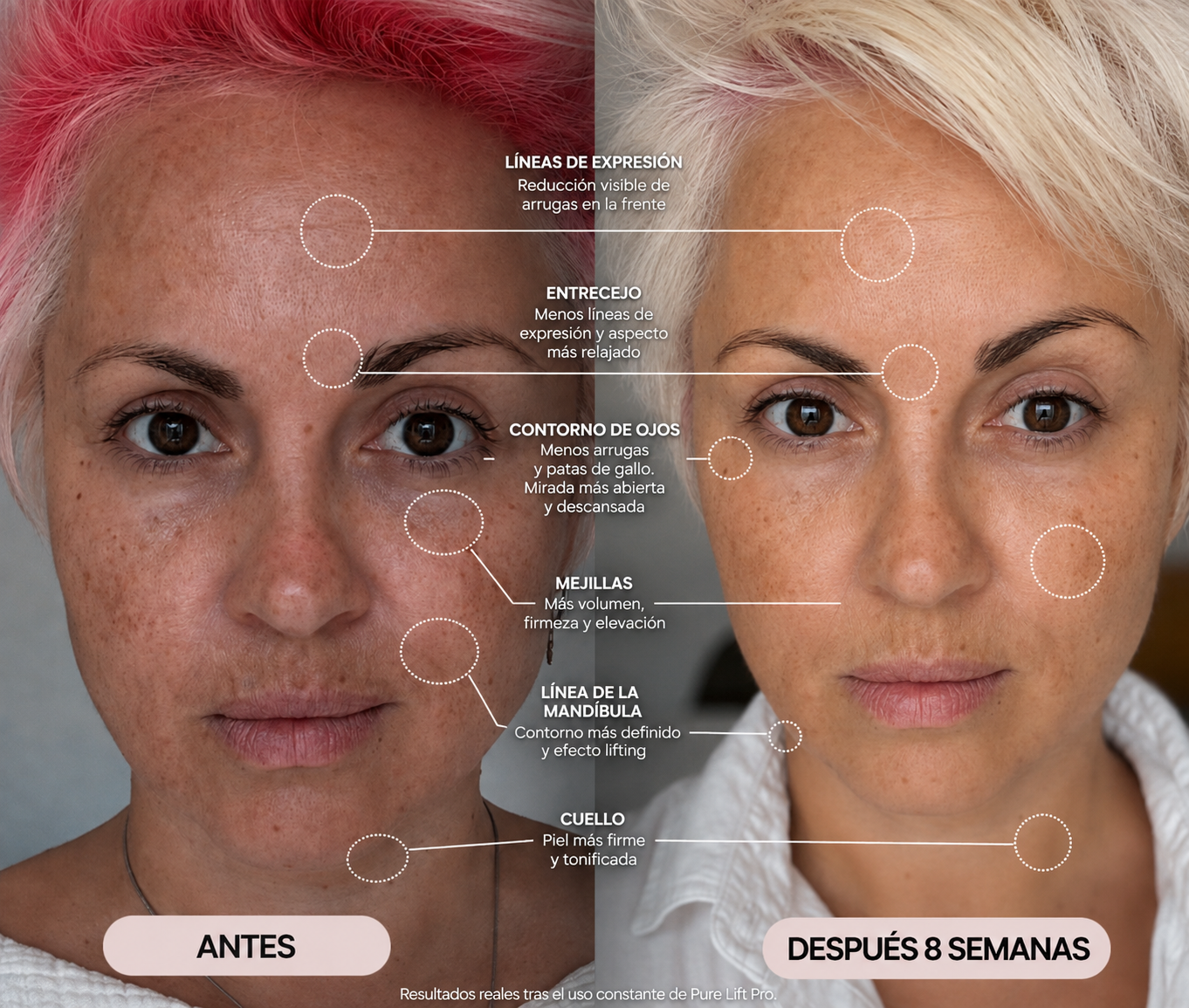 PURE LIFT PRO Tonificador Microcorriente facial